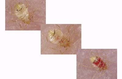 A bedbug in the process of hatching