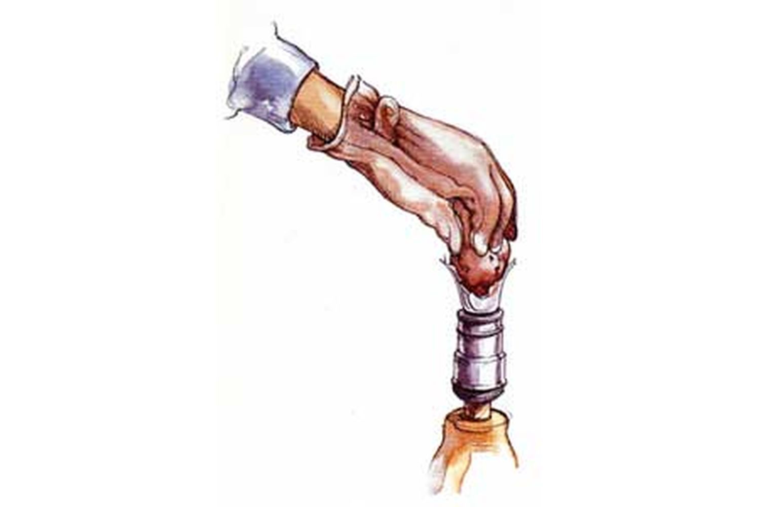 A drawing of a person wearing a glove removing a stuck light bulb.